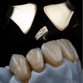 Двойна светкавица Мека светлина студиен клиничен вътрешността на устата черно на бял фон ефект на зъба Сверхтонкое осветление стека стрелба